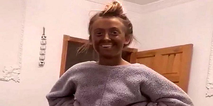 بلایی که یک کِرِم تقلبی بر سر صورت دختر جوان آورد
